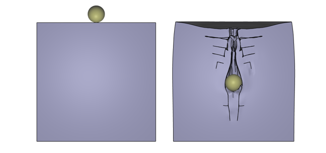 Spherical impactor against gelatin like material